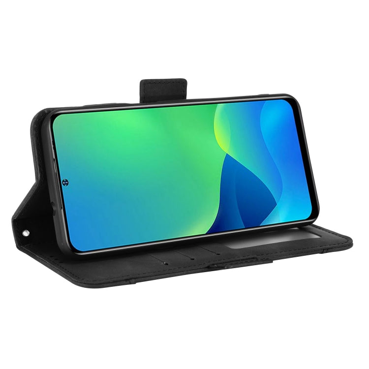 For Ulefone Note 13P Skin Feel Calf Pattern Leather Phone Case(Black) by buy2fix