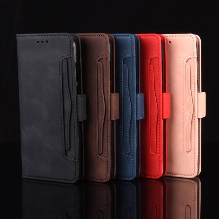 For UMIDIGI Bison Wallet Style Skin Feel Calf Pattern Leather Case with Separate Card Slot(Black) by buy2fix
