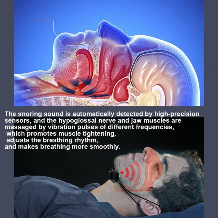 USB Rechargeable Smart Anti-snoring Device Home Snoring Corrector(Black) by buy2fix