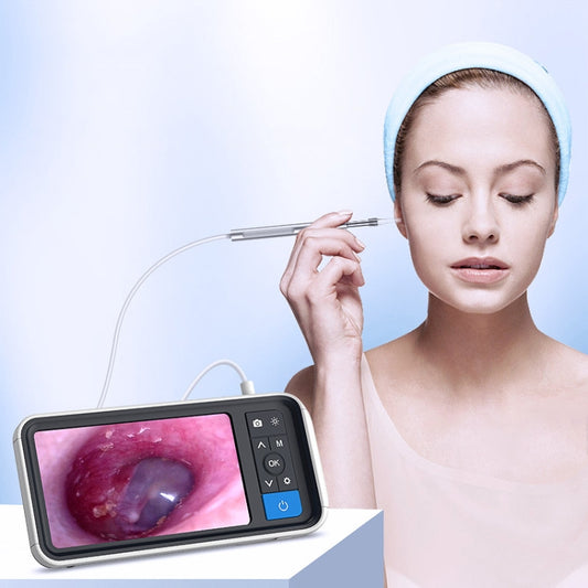 TESLONG MS450 4.5 inch HD Smart Screen Otoscope with 32GB Memory Card by buy2fix