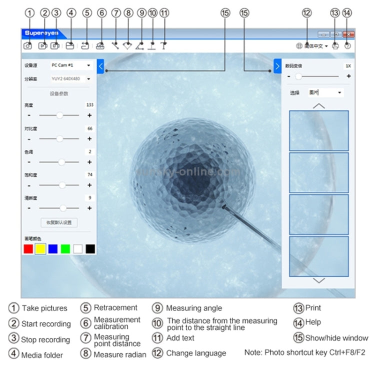 Supereyes Y001+ 4mm Focusable Tube Nasal Throat Oral Electronic Endoscope by Supereyes