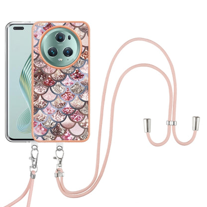 For Honor Magic5 Pro Electroplating IMD TPU Phone Case with Lanyard(Pink Scales) - Honor Cases by buy2fix | Online Shopping UK | buy2fix