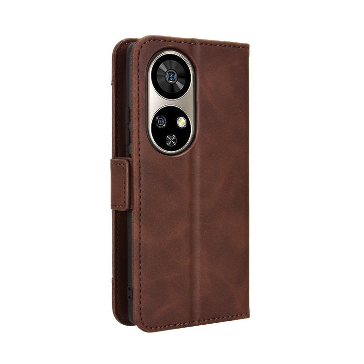 For Ulefone Note 17 Pro Skin Feel Calf Texture Card Slots Leather Phone Case(Brown) by buy2fix