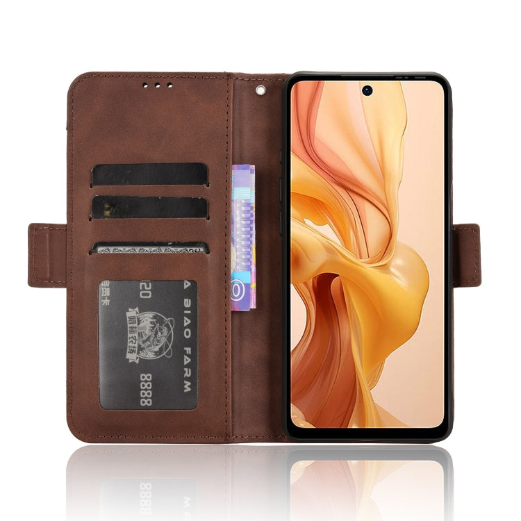 For Ulefone Note 18 Ultra Skin Feel Calf Texture Card Slots Leather Phone Case(Brown) by buy2fix