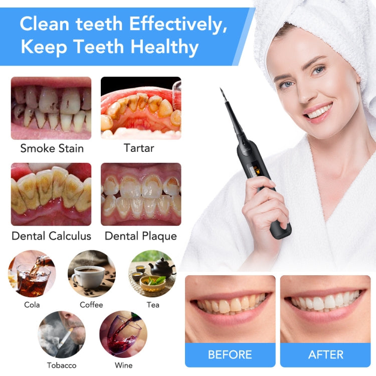 Dental Cleaning And Scaler Household Portable Electric Dental Care Tool Beauty Dental Instrument - Oral Irrigators by buy2fix | Online Shopping UK | buy2fix